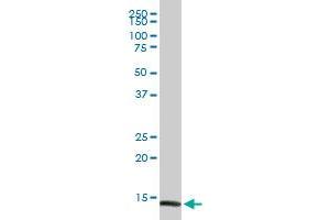 FABP4 MaxPab rabbit polyclonal antibody. (FABP4 Antikörper  (AA 1-132))