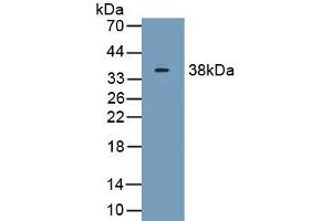 Detection of Recombinant C1qB, Human using Polyclonal Antibody to Complement Component 1, Q Subcomponent B (C1qB) (C1QB Antikörper  (AA 28-253))