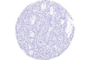 anti-C-Peptide antibody