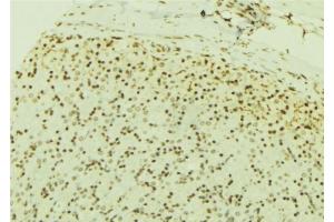 ABIN6277190 at 1/100 staining Human gastric tissue by IHC-P. (USP7 Antikörper  (Internal Region))