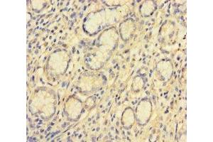 Immunohistochemistry of paraffin-embedded human stomach tissue using ABIN7175533 at dilution of 1:100 (VKORC1L1 Antikörper  (AA 38-91))