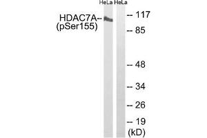 Western blot analysis of extracts from HeLa cells using HDAC7A (Phospho-Ser155) Antibody. (HDAC7 Antikörper  (pSer155))