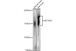 Western blot analysis of extracts of various cell lines, using SLC12 antibody (ABIN6131136, ABIN6147843, ABIN6147844 and ABIN6215366) at 1:500 dilution. (SLC12A2 Antikörper  (AA 120-280))