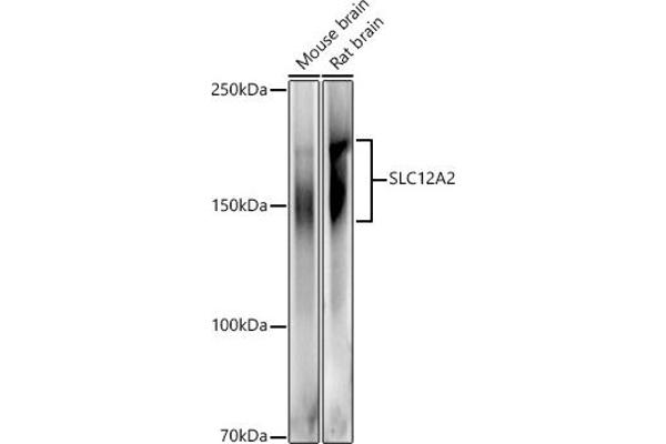 SLC12A2 Antikörper  (AA 120-280)
