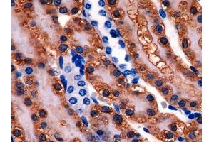 DAB staining on IHC-P; Samples: Rat Kidney Tissue (Glutathione Synthetase Antikörper  (AA 270-474))