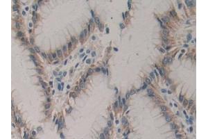 DAB staining on IHC-P; Samples: Human Stomach Tissue (CSF2RA Antikörper  (AA 204-360))