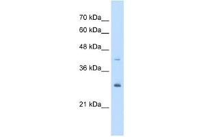 CACYBP antibody used at 5 ug/ml to detect target protein. (CACYBP Antikörper  (Middle Region))