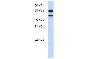SF4 antibody used at 1 ug/ml to detect target protein. (Splicing Factor 4 Antikörper  (Middle Region))