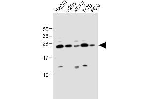 All lanes : Anti-SCXA Antibody (C-term) at 1:1000 dilution Lane 1: HACAT whole cell lysate Lane 2: U-2OS whole cell lysate Lane 3: MCF-7 whole cell lysate Lane 4: T47D whole cell lysate Lane 5: PC-3 whole cell lysate Lysates/proteins at 20 μg per lane. (SCXA Antikörper  (C-Term))