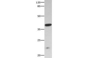 Gel: 10 % SDS-PAGE Lysate: 40 μg Mouse skeletal muscle tissue lysate Primary antibody: 1/300 dilution Secondary antibody: Goat anti Rabbit IgG - H&L (HRP) at 1/10000 dilution Exposure time: 60 seconds (CNTF Receptor alpha Antikörper  (AA 23-342))
