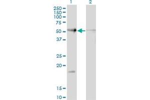 Western Blot analysis of RAD23B expression in transfected 293T cell line by RAD23B monoclonal antibody (M10), clone 3H7. (RAD23B Antikörper  (AA 311-409))