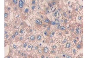 Detection of PAH in Human Liver Tissue using Polyclonal Antibody to Phenylalanine Hydroxylase (PAH) (Phenylalanine Hydroxylase Antikörper  (AA 228-452))