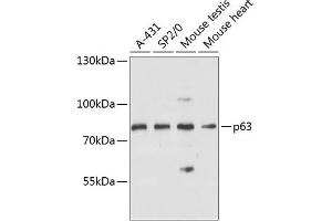 Western blot analysis of extracts of various cell lines, using p63 antibody (ABIN6133471, ABIN6149424, ABIN6149427 and ABIN6216755) at 1:3000 dilution. (p63 Antikörper  (AA 1-160))
