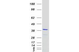Skeletal Troponin T (Transcript Variant 1) protein (Myc-DYKDDDDK Tag)
