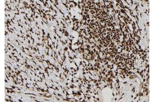 ABIN6277792 at 1/100 staining Human gastric tissue by IHC-P. (Calretinin Antikörper  (C-Term))