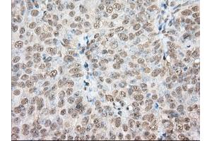 Immunohistochemical staining of paraffin-embedded Human colon tissue using anti-PDE4A mouse monoclonal antibody. (PDE4A Antikörper)