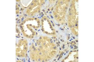 Immunohistochemistry of paraffin-embedded human kidney using CIAO1 antibody (ABIN5975509) at dilution of 1/100 (40x lens). (CIAO1 Antikörper)