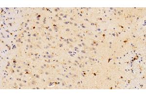 Immunohistochemistry (IHC) image for anti-Ionized Calcium-binding Adapter Molecule 1 (IBA1) (AA 1-147) antibody (ABIN7437545)