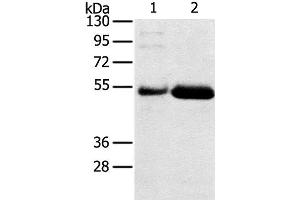 Western Blot analysis of Human placenta and stomach cancer tissue using SAMD3 Polyclonal Antibody at dilution of 1:400 (SAMD3 Antikörper)