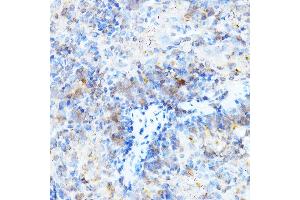 Immunohistochemistry of paraffin-embedded mouse spleen using ULBP1 Rabbit pAb (ABIN6128898, ABIN6149917, ABIN6149918 and ABIN6214755) at dilution of 1:500 (40x lens).