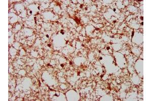 Immunohistochemistry (IHC) image for anti-P21-Activated Kinase 4 (PAK4) (AA 1-426) antibody (ABIN7169132)