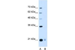 WB Suggested Anti-PLAC1L Antibody Titration:  0. (PLAC1L Antikörper  (Middle Region))