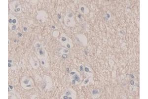 Detection of UCRP in Human Cerebrum Tissue using Polyclonal Antibody to Ubiquitin Cross Reactive Protein (UCRP) (CLRN1 Antisense RNA 1 (CLRN1-AS1) (AA 2-157) Antikörper)
