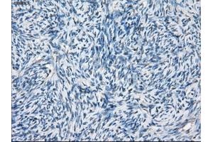 Immunohistochemical staining of paraffin-embedded Ovary tissue using anti-BCKDK mouse monoclonal antibody. (BCKDK Antikörper)