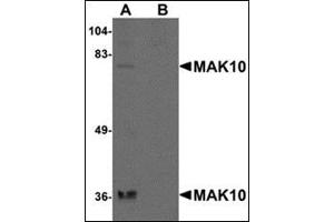 Western blot analysis of MAK10 in rat heart tissue lysate with this product at 1 μg/ml in the (A) absence and (B) presence of blocking peptide. (MAK10/NAA35 Antikörper  (N-Term))