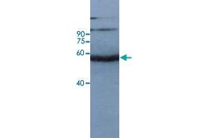 Western blot analysis of rice leaf tissue at seeding stage with Os11g0163600 polyclonal antibody  at 1:10000 dilution. (OS11G0163600 Antikörper)