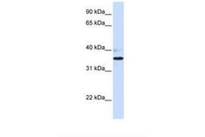 Image no. 1 for anti-UDP-Gal:betaGlcNAc beta 1,3-Galactosyltransferase, Polypeptide 1 (B3GALT1) (N-Term) antibody (ABIN6738584)