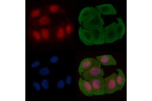 ABIN6255330 and ABIN6277725 staining Hela cells(30 min of UV treatment) by IF/ICC. (ATR Antikörper  (pSer428))