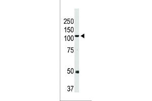 Western Blotting (WB) image for anti-Bone Morphogenetic Protein Receptor, Type II (serine/threonine Kinase) (BMPR2) (AA 28-59), (N-Term) antibody (ABIN5535544)