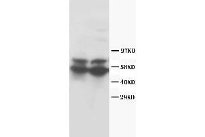 Anti-RUNX2 antibody, Western blotting Lane 1: Rat Thymus Tissue Lysate Lane 2: Rat Testis Tissue Lysate (RUNX2 Antikörper  (Middle Region))