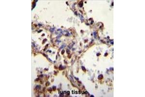 WDR52 Antibody (C-term) immunohistochemistry analysis in formalin fixed and paraffin embedded human lung tissue followed by peroxidase conjugation of the secondary antibody and DAB staining. (WDR52 Antikörper  (C-Term))