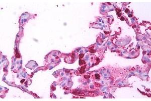Anti-Macrophages antibody IHC staining of human lung, macrophages. (Macrophages Antikörper)