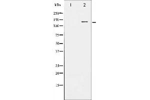 Western blot analysis of KIT phosphorylation expression in EGF treated HepG2 whole cell lysates,The lane on the left is treated with the antigen-specific peptide.
