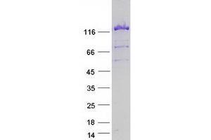 Western Blotting (WB) image for Ubiquitin Specific Peptidase 8 (USP8) (Transcript Variant 2) protein (Myc-DYKDDDDK Tag) (ABIN2735146)