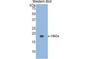 Western blot analysis of the recombinant protein. (RBP2 Antikörper  (AA 1-134))