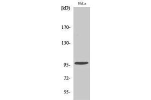 Western Blotting (WB) image for anti-Checkpoint Kinase 2 (CHEK2) (pThr68) antibody (ABIN3179414) (CHEK2 Antikörper  (pThr68))