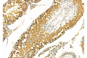 ABIN6266241 and ABIN6277393 at 1/100 staining Rat testis tissue by IHC-P. (Kallikrein 2 Antikörper  (Internal Region))
