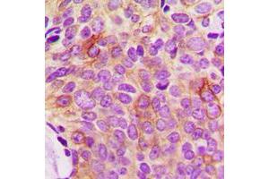 Immunohistochemistry (IHC) image for anti-Tumor Necrosis Factor Receptor Superfamily, Member 11b (TNFRSF11B) (N-Term) antibody (ABIN7299384)