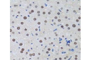 Immunohistochemistry of paraffin-embedded Rat liver using MTA3 Polyclonal Antibody at dilution of 1:100 (40x lens). (MTA3 Antikörper)