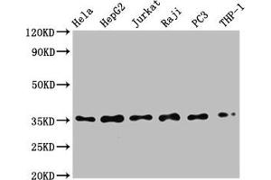 Western Blot Positive WB detected in: Hela whole cell lysate, HepG2 whole cell lysate, Jurkat whole cell lysate, Raji whole cell lysate, PC3 whole cell lysate, THP-1 whole cell lysate All lanes: NFKBIA antibody at 0. (Rekombinanter NFKBIA Antikörper)