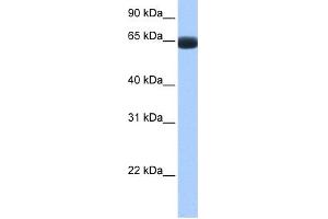 WB Suggested Anti-ARHGAP28 Antibody Titration: 0.