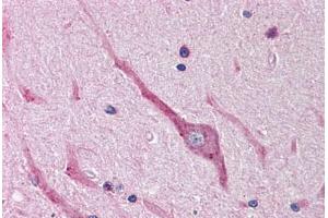 Human Brain, Cerebellum (formalin-fixed, paraffin-embedded) stained with SNAI2 antibody ABIN214479 at 2. (SLUG Antikörper  (Internal Region))