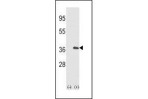Western blot analysis of IL1A (arrow) using rabbit polyclonal IL1A-pS87 (ABIN390844 and ABIN2841070). (IL1A Antikörper  (AA 65-94))