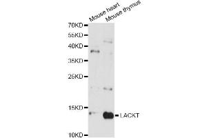 Western blot analysis of extracts of various cell lines, using LACRT antibody (ABIN6293118) at 1:3000 dilution. (Lacritin Antikörper)