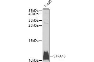 Western blot analysis of extracts of H460 cells using STRA13 Polyclonal Antibody at dilution of 1:1000. (STRA13 Antikörper)