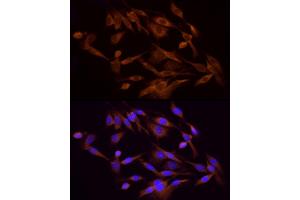 Immunofluorescence analysis of PC-12 cells using PI3 Kinase p85 alpha Rabbit pAb (ABIN6130616, ABIN6145641, ABIN6145644 and ABIN6215094) at dilution of 1:100 (40x lens). (PIK3R1 Antikörper)